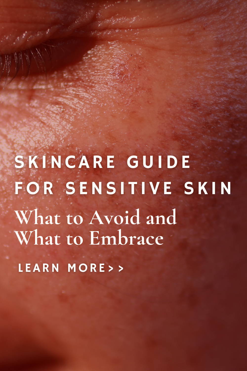Navigating Skincare for Sensitive Skin What to Avoid and What to Embr